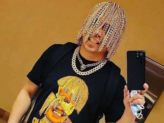 Сучасна Золотоволоска: репер імплантував собі в череп золоті ланцюжки замість волосся